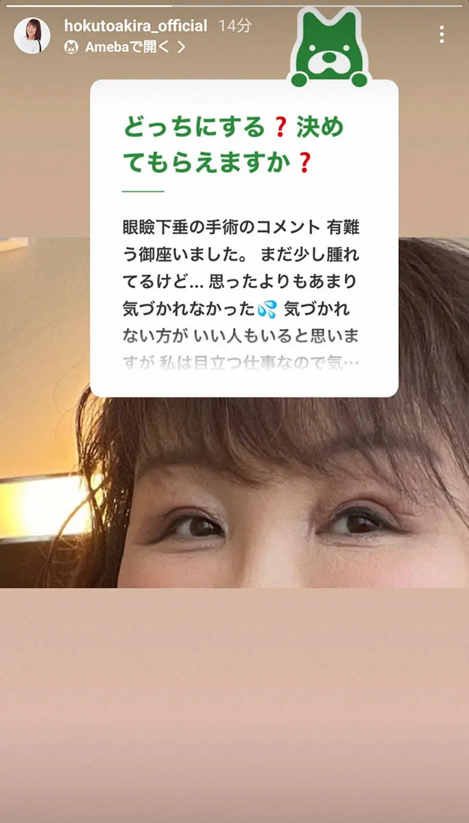 【画像・写真】北斗晶　眼瞼下垂の手術を受けたと報告「視界が狭くて周りが見えづらかったので　思い切って」