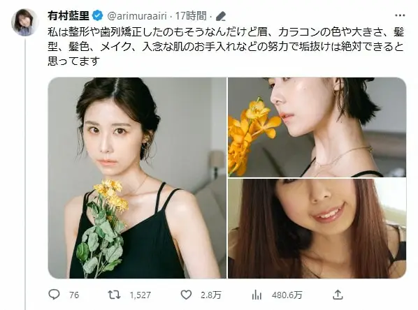 【画像・写真】有村藍里、美容整形の“ビフォーアフター”公開「努力で垢抜けは絶対できる」とメッセージも