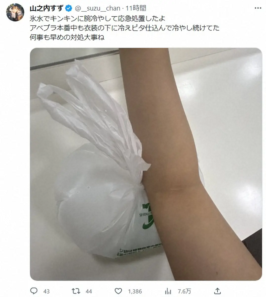 【画像・写真】山之内すず「右肘強打しまして…」　外傷なしも「めちゃくちゃ痛い」　生放送中に応急処置していたと明かす