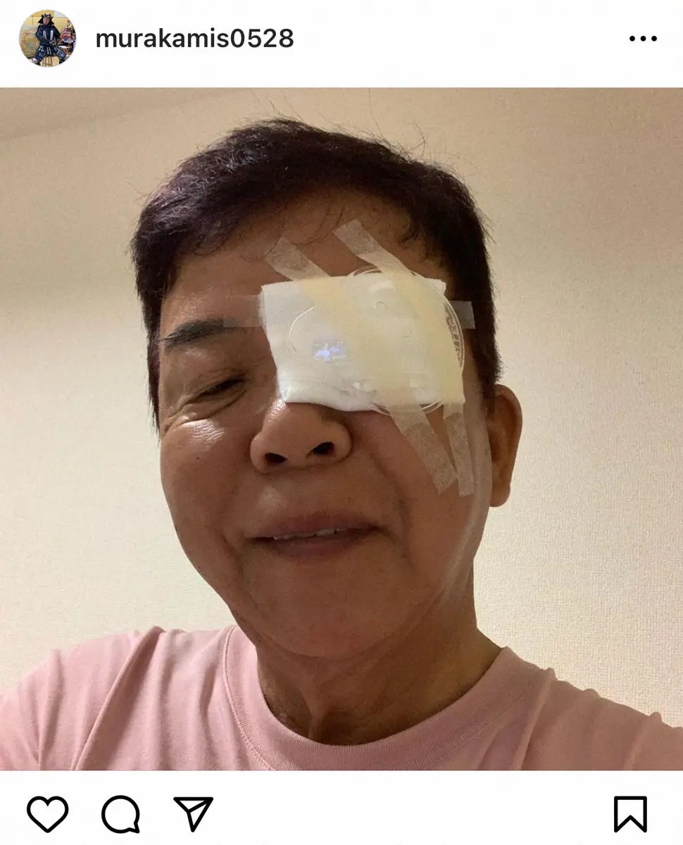 【画像・写真】村上ショージ　目の手術「無事に終わりました」　左目をガーゼなどで保護した痛々しい姿も