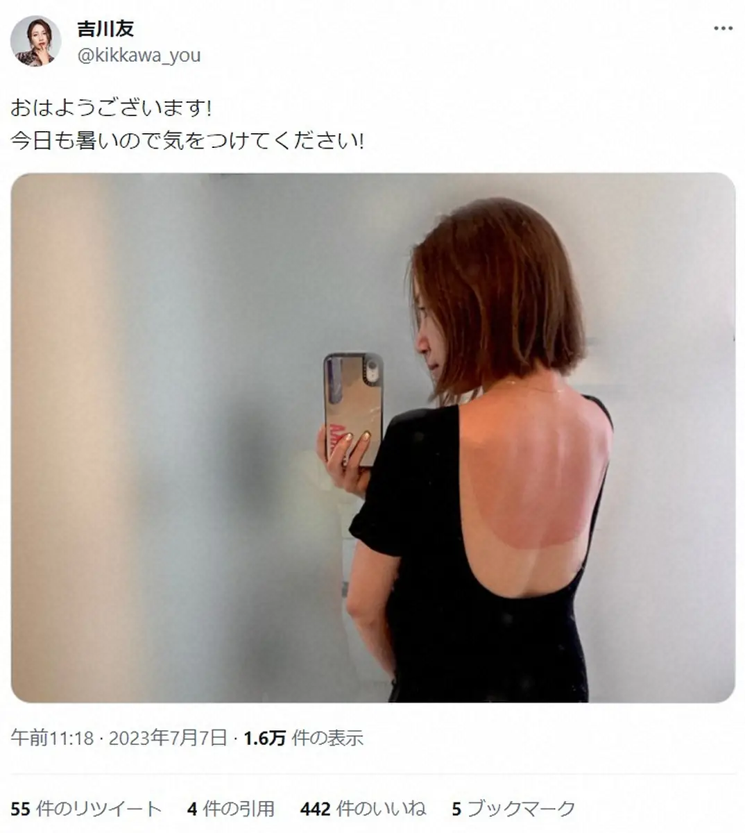【画像・写真】吉川友「どうすればいいですか」　真っ赤にただれた背中公開「痛そう…」「皮膚科行った方が」と心配の声