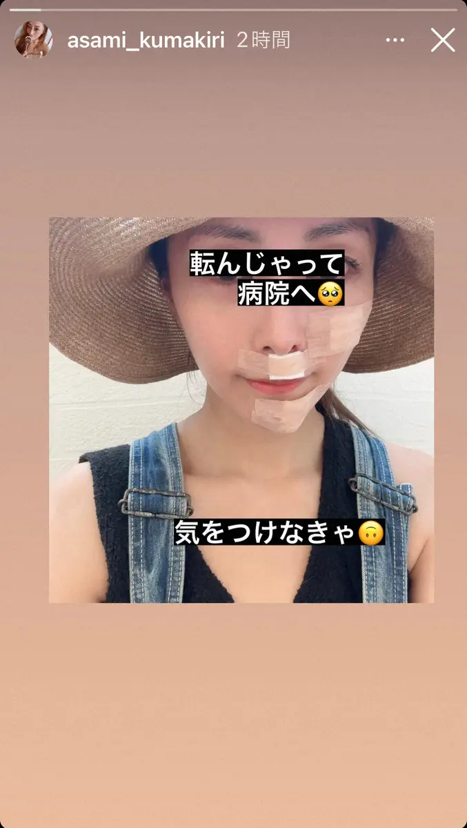 【画像・写真】熊切あさ美「転んじゃって病院へ」痛々しい顔にファン「結構ひどい」「大丈夫ですか？」「お大事に」