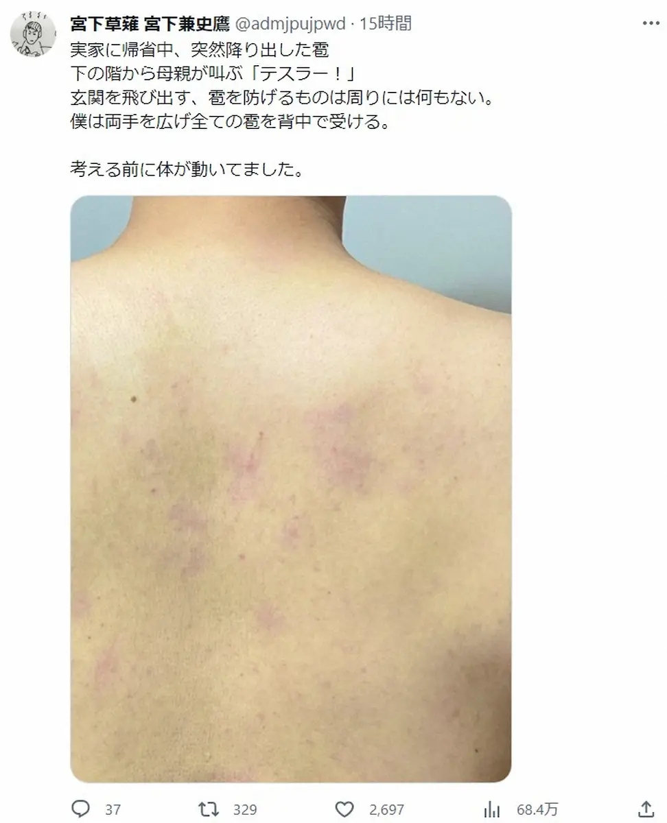 【画像・写真】宮下草薙・宮下兼史鷹「考える前に動いてました」　体張ってひょうから愛車守り　アザだらけの背中公開
