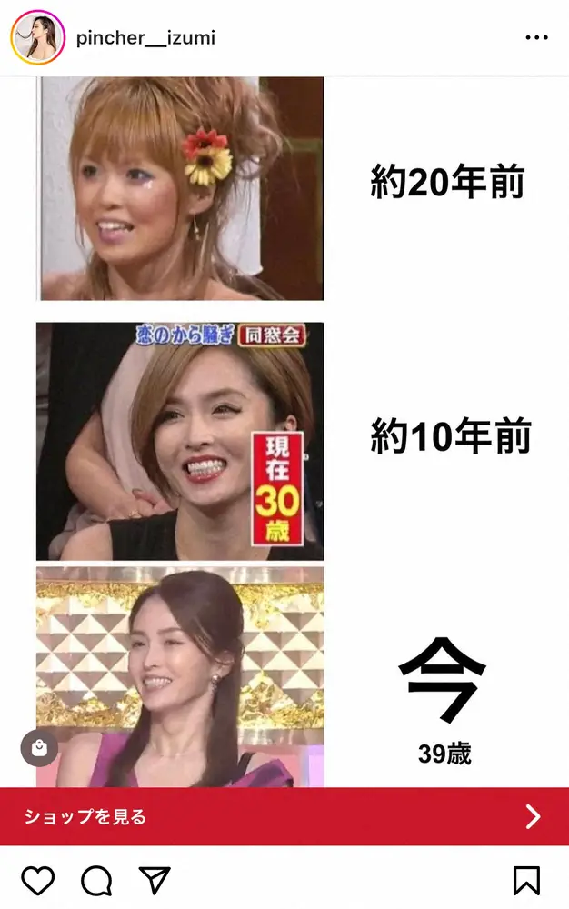 【画像・写真】“恋から出身”元タレントが整形告白　費用総額1000万！顔、胸…番組卒業後にメスを入れたワケ