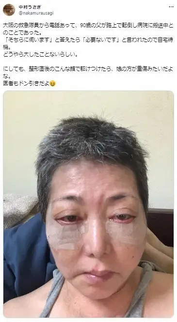 【画像・写真】整形直後の中村うさぎ、90歳の父が救急搬送も…「こんな顔で駆けつけたら医者もドン引きだよ」無事を報告