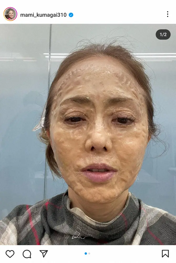 【画像・写真】熊谷真実　閲覧注意！？「これぞゾンビ」衝撃の姿公開に「特殊メイクかと」「私もやらなきゃ」の声