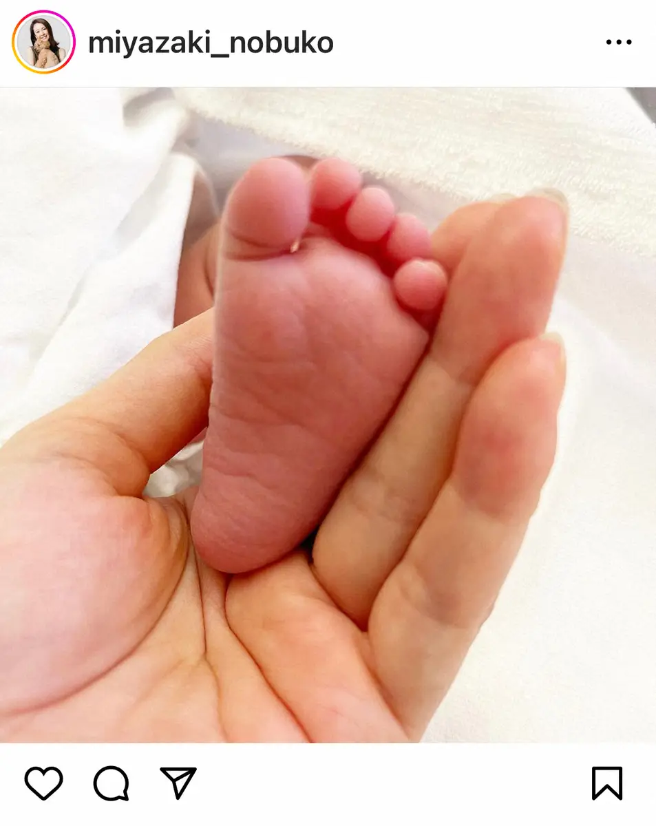 【画像・写真】宮崎宣子　「壮絶な帝王切開」で第1子出産　退院が1週間伸びたと報告「今日退院予定だったのですが」