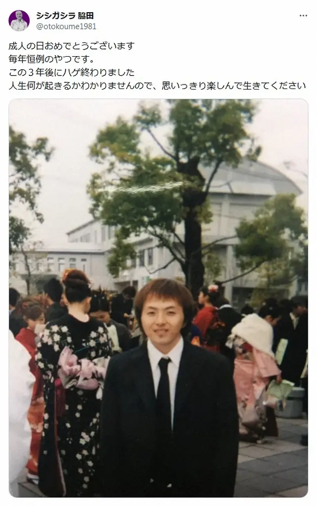 【画像・写真】M－1“ハゲネタ”で笑わせたシシガシラ脇田、22年前の成人式写真公開に驚きの声上がる「藤原竜也だ！」