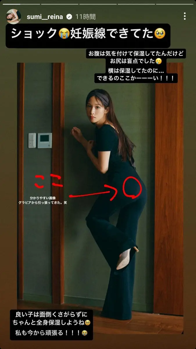 【画像・写真】第1子妊娠中の鷲見玲奈　お尻の部分に…妊婦ならではの悩み明かす「ショック…夫が良くても自分が」