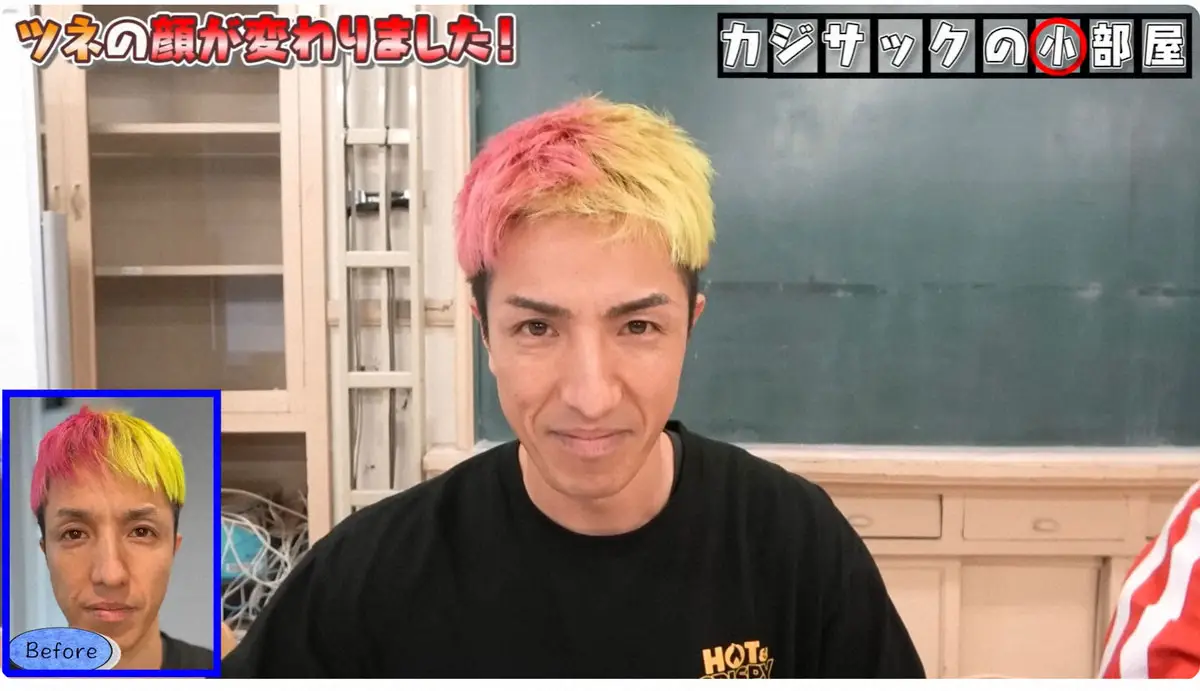 【画像・写真】元2700・ツネ　“老け顔”の悩み解決へ決断「明らかに違う」大満足も…家族からは不評「なんか変だね」