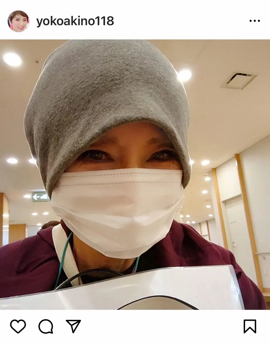 【画像・写真】秋野暢子　「またまた検査」と報告「12月に撮ったMRIにちょっと疑問な所が…」「サバイバーあるある」