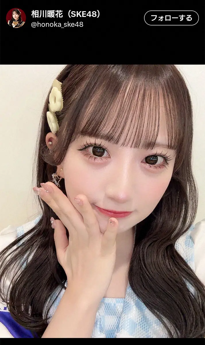 【画像・写真】SKE48・相川暖花　親知らずを4本抜いたと報告　腫れあがった顔に「四角い」「加工だと」と驚きの声