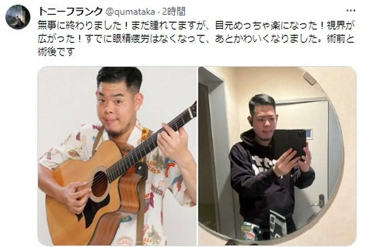 【画像・写真】元R－1準V芸人　二重手術「無事に終わりました！」　目元すっきり術後写真に「かわいい」の声も