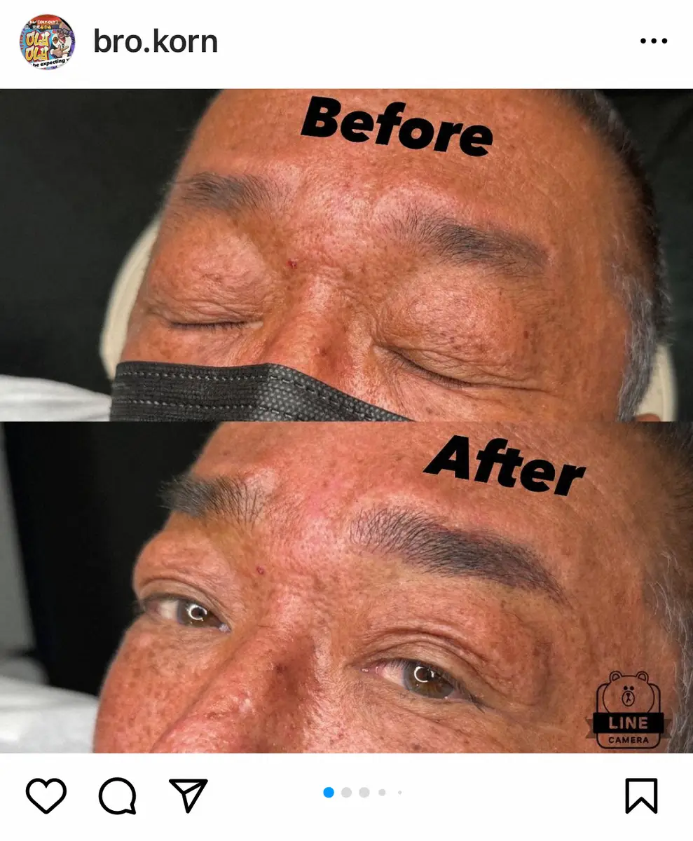 【画像・写真】ブラザー・コーン　眉毛アートメイク報告「抗がん剤治療で全身の毛が抜け…せめて眉毛はなんとかしたいと」