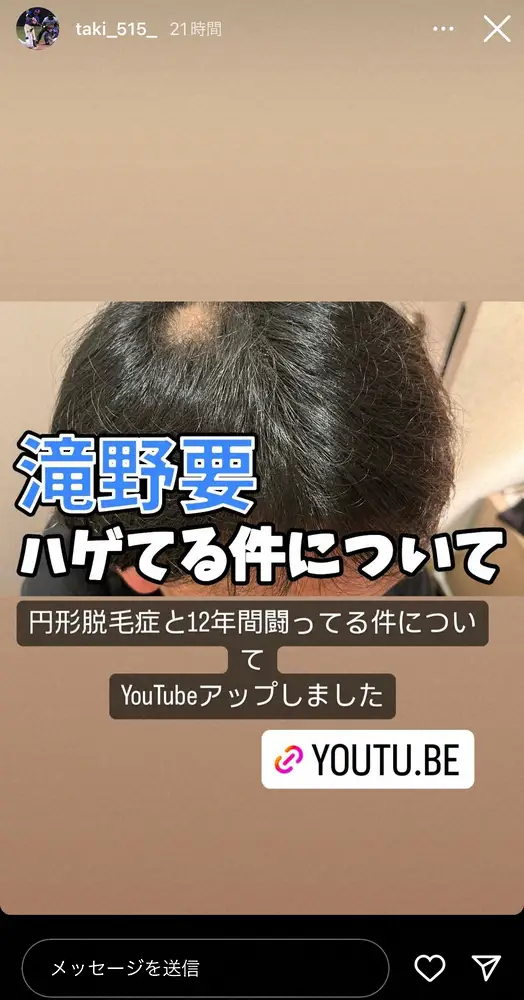 【画像・写真】元中日・滝野要氏　「僕は円形脱毛症」と公表　戦力外、自立神経の病気、離婚…苦難続く中、闘病12年