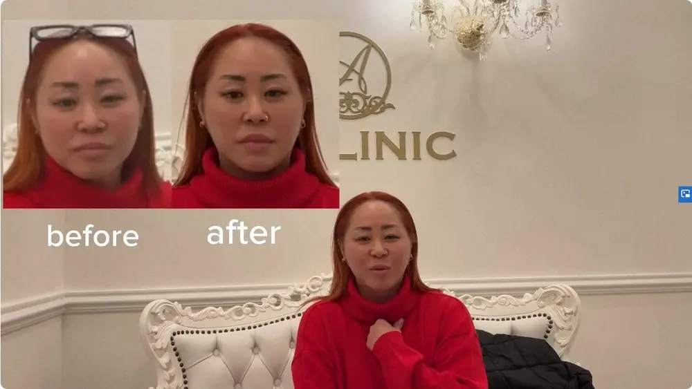 【画像・写真】Mr.マリック娘、22キロ減量の次は美容整形に挑戦“1day小顔”で効果実感「大大大満足です！」