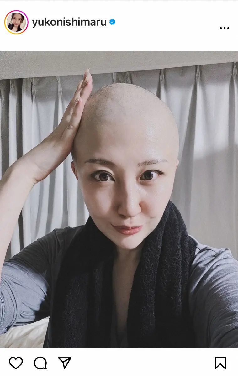 【画像・写真】子宮体がん公表の女優　2回目の抗がん剤治療から2週間　告白した不安なこと「年齢的に考えたら」