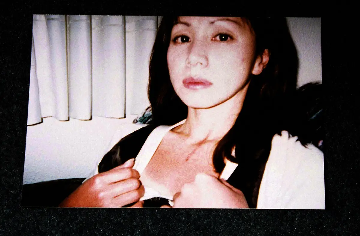 1997年、「サイパン乱闘事件」で俊恵夫人の当時の傷を撮った写真