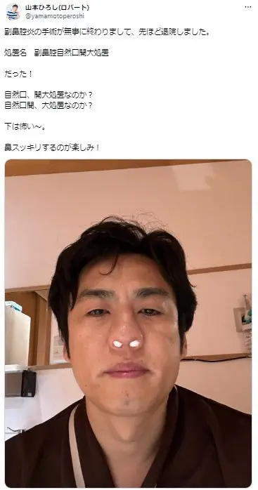 【画像・写真】ロバート山本、副鼻腔炎の手術を受けていた　「全身麻酔残り顔」に驚きの声「ボクシング後みたいなお顔…」