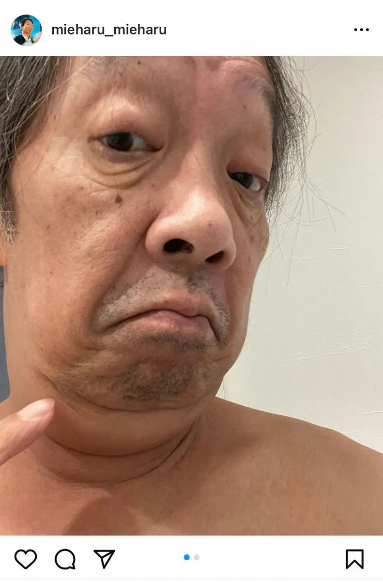 【画像・写真】下咽頭がんステージ4　見栄晴、副作用で「とうとうYシャツの1番上のボタンが閉まらなくなる程に…」