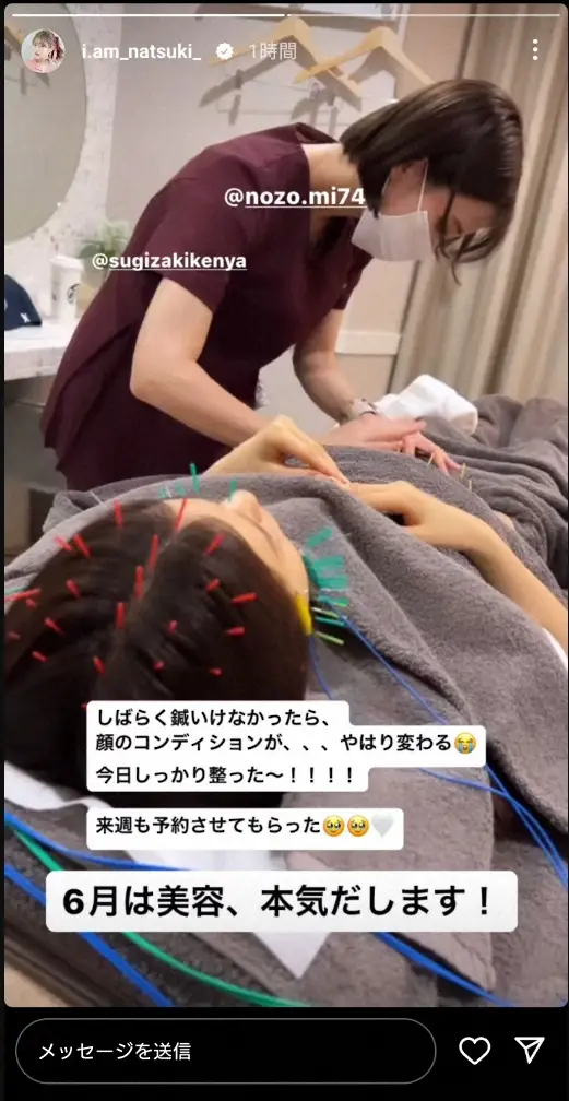 【画像・写真】“令和の峰不二子”阿部なつき　鍼で顔面コンディションアップし 「しっかり整った～！！！！来週も…」