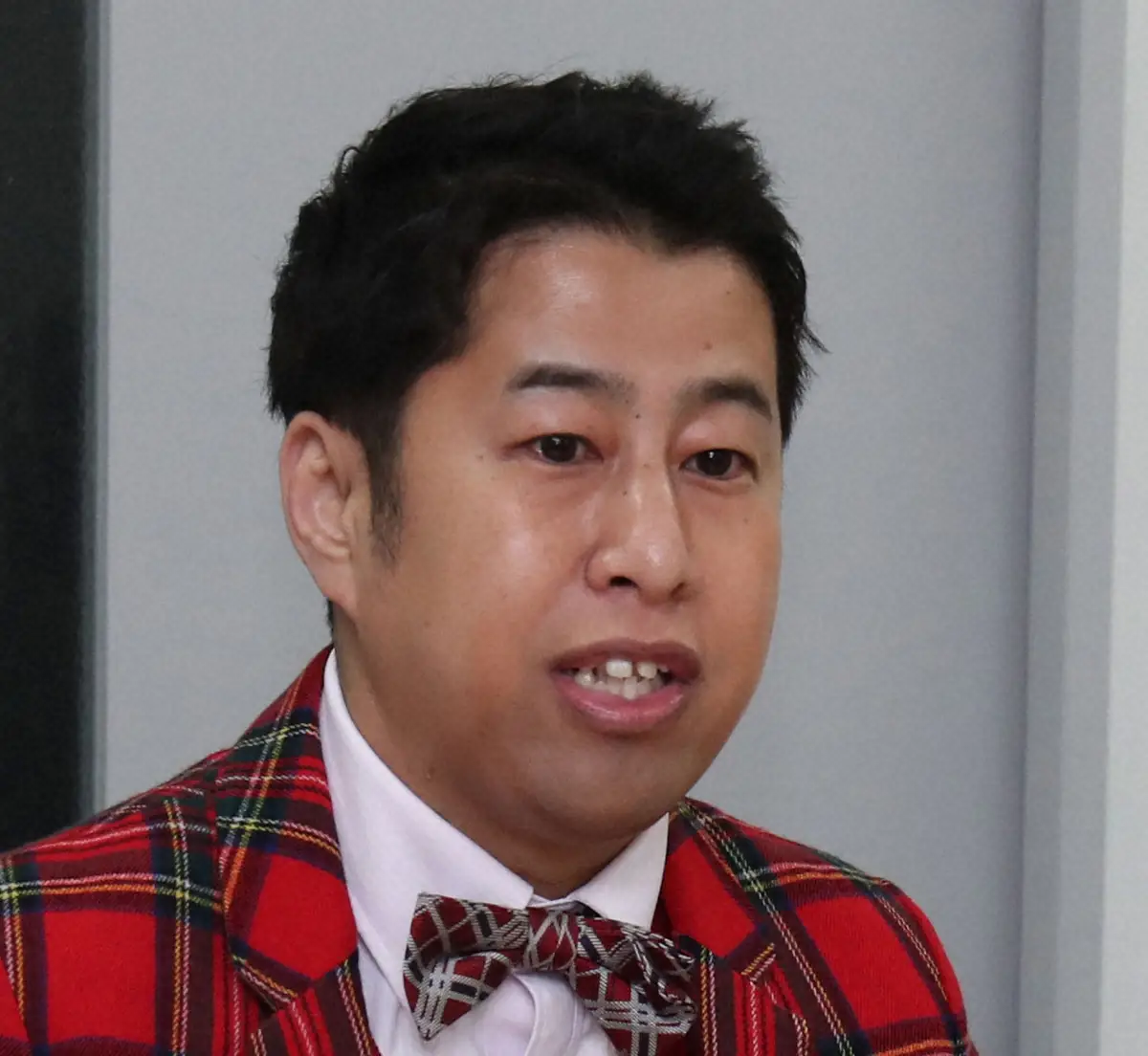 【画像・写真】ウエストランド井口　口腔CT検査で驚がくの結果！まさかの場所に歯が…「2列とかの問題じゃない」