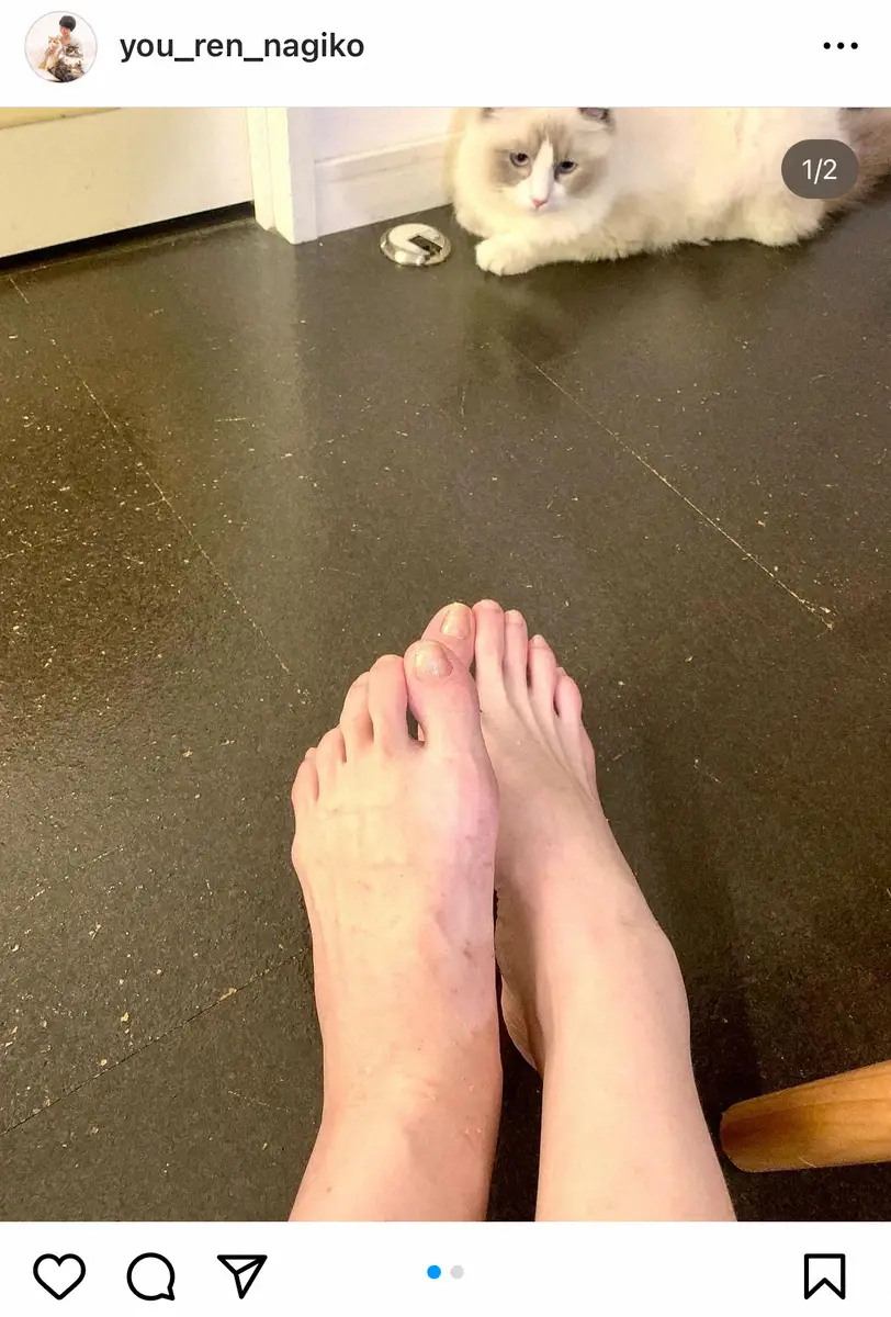 【画像・写真】遠野なぎこ「こんなんなっちゃった」多くの傷で腫れた足公開「歳だし、もう傷跡は消えないかもな」