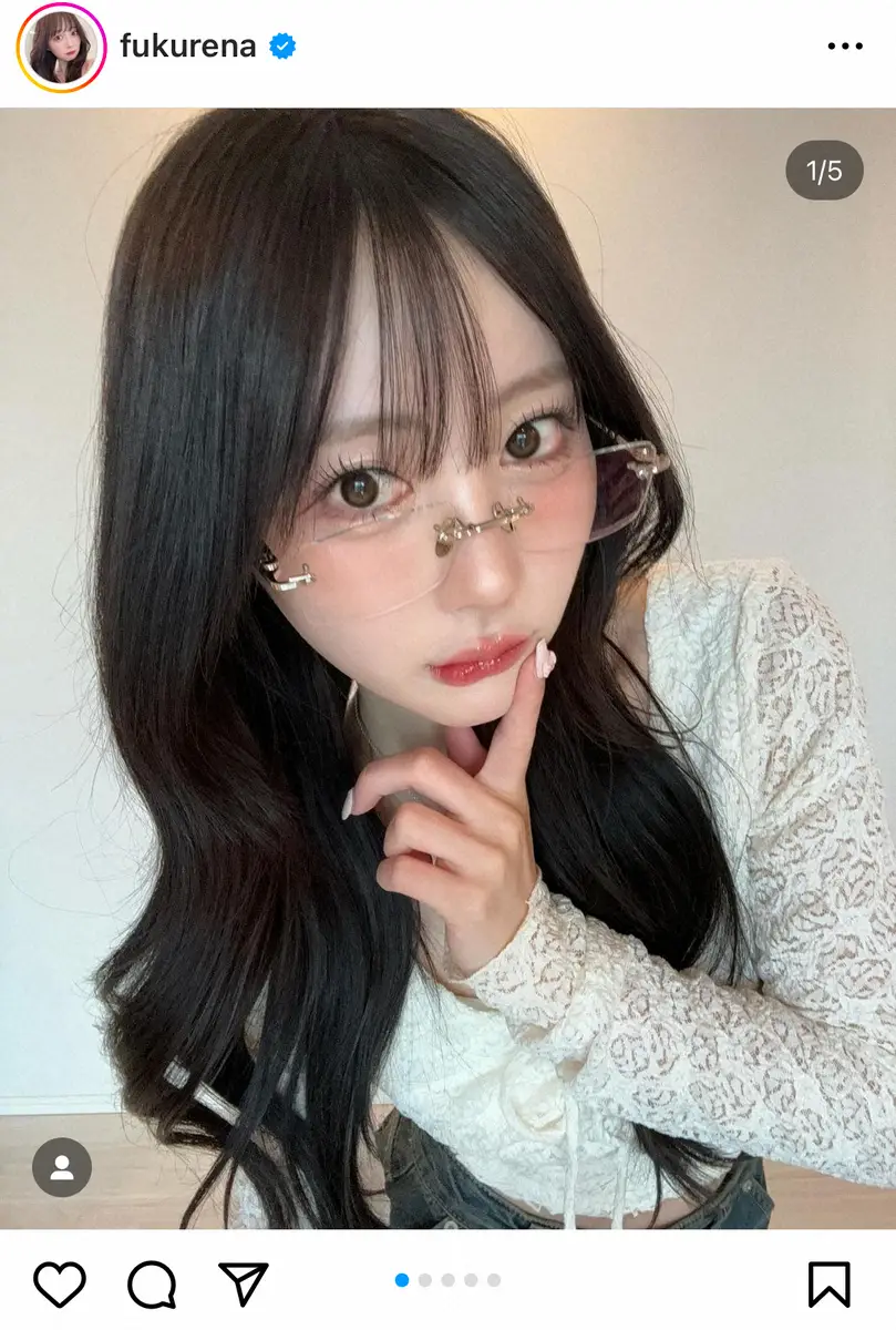 【画像・写真】人気ユーチューバー・ふくれな　鼻の整形を報告「依存症かもしれん…自覚はしてるんですよ。でも」