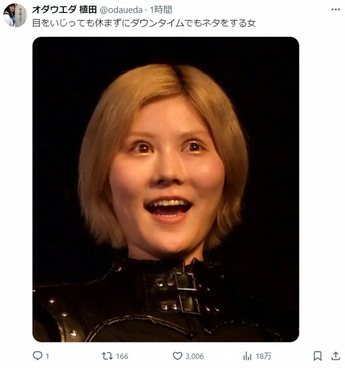 【画像・写真】オダウエダ小田、目を整形　ダウンタイム中もネタ披露　相方・植田「目をいじっても休まず…」