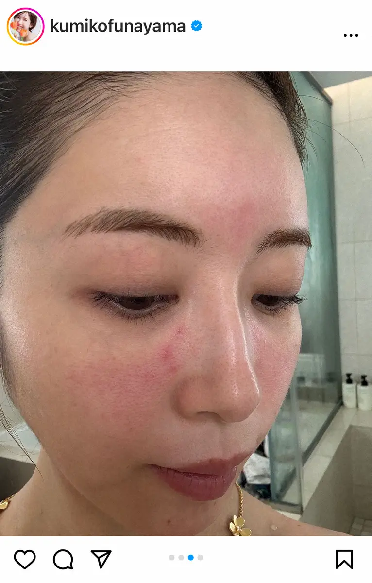 【画像・写真】第2子妊娠中の舟山久美子　「悪阻時期の肌荒れ」について告白　オシャレなマタニティーコーデも披露