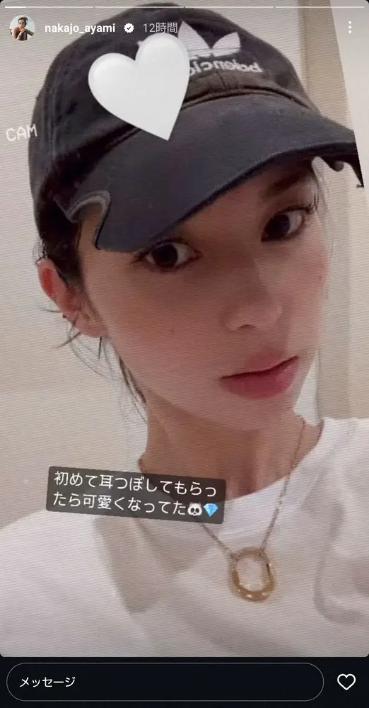 【画像・写真】中条あやみ「可愛くなってた」　ピアスだらけ!?どアップのプライベートショットで衝撃の耳の姿公開