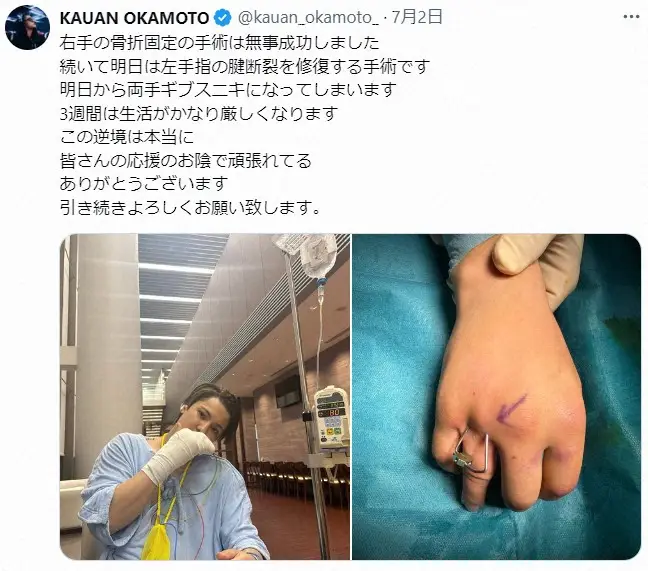 【画像・写真】カウアン・オカモト　両手を手術で「介護生活」　激痛…腫れた患部公開「自分1人じゃ生きていけない」