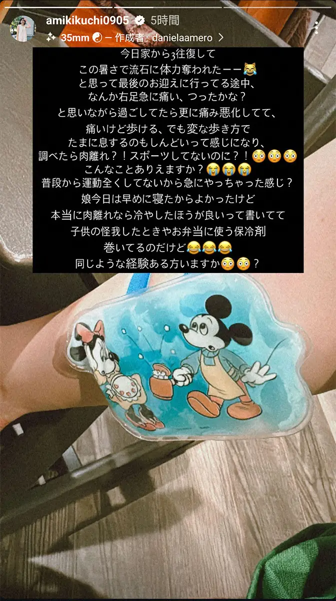 【画像・写真】最初は脱水症状と気づかず、足を冷やす菊地亜美。インスタグラム（@amikikuchi0905）から