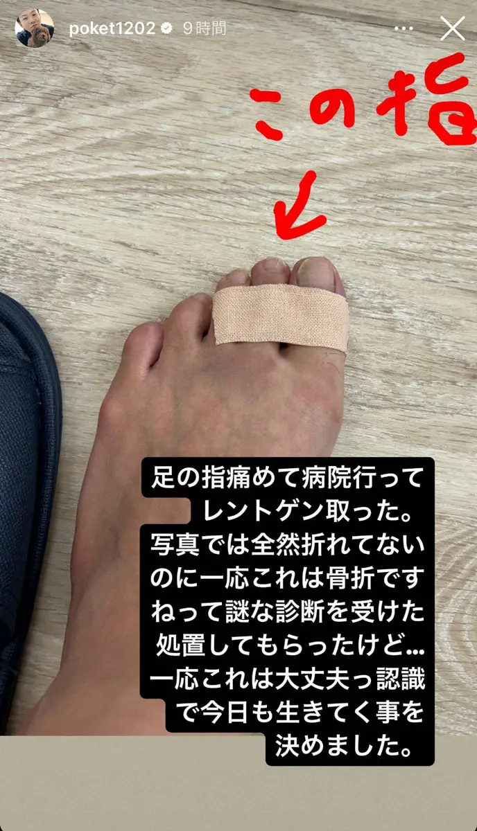 【画像・写真】ジャンポケおたけ　左足人差し指を骨折も…「写真では全然折れてない」「謎な診断を受けた」