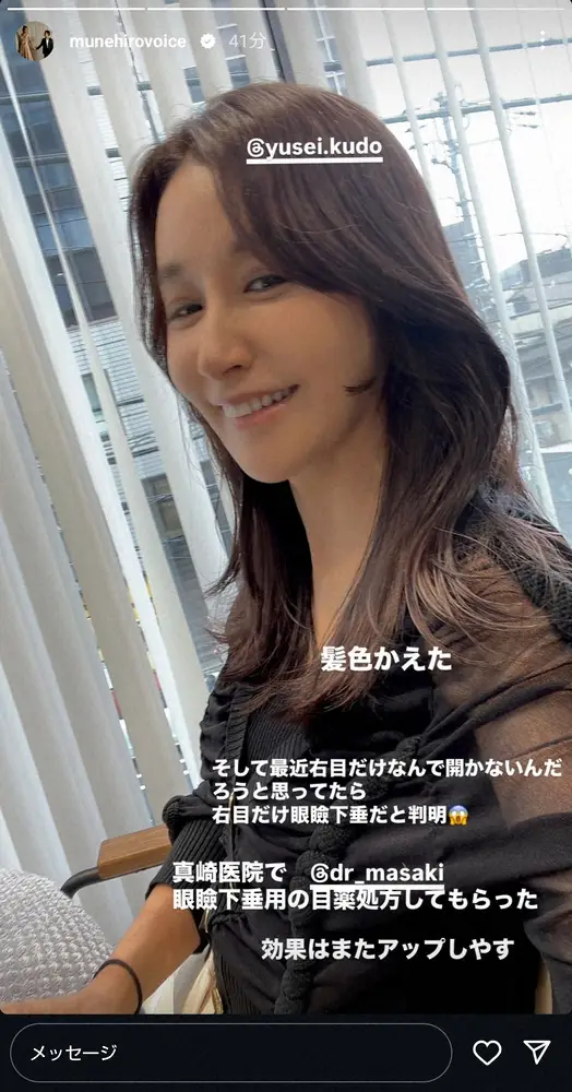 【画像・写真】47歳・鈴木紗理奈、眼瞼下垂告白「最近右目だけ…」過去には北斗晶、和田アキ子らも治療の症状