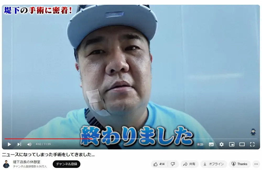 【画像・写真】インパルス堤下、顔の手術成功　「臭い」から発覚した皮下腫瘍…右頬に大きな手術の傷「凄く痛かった」