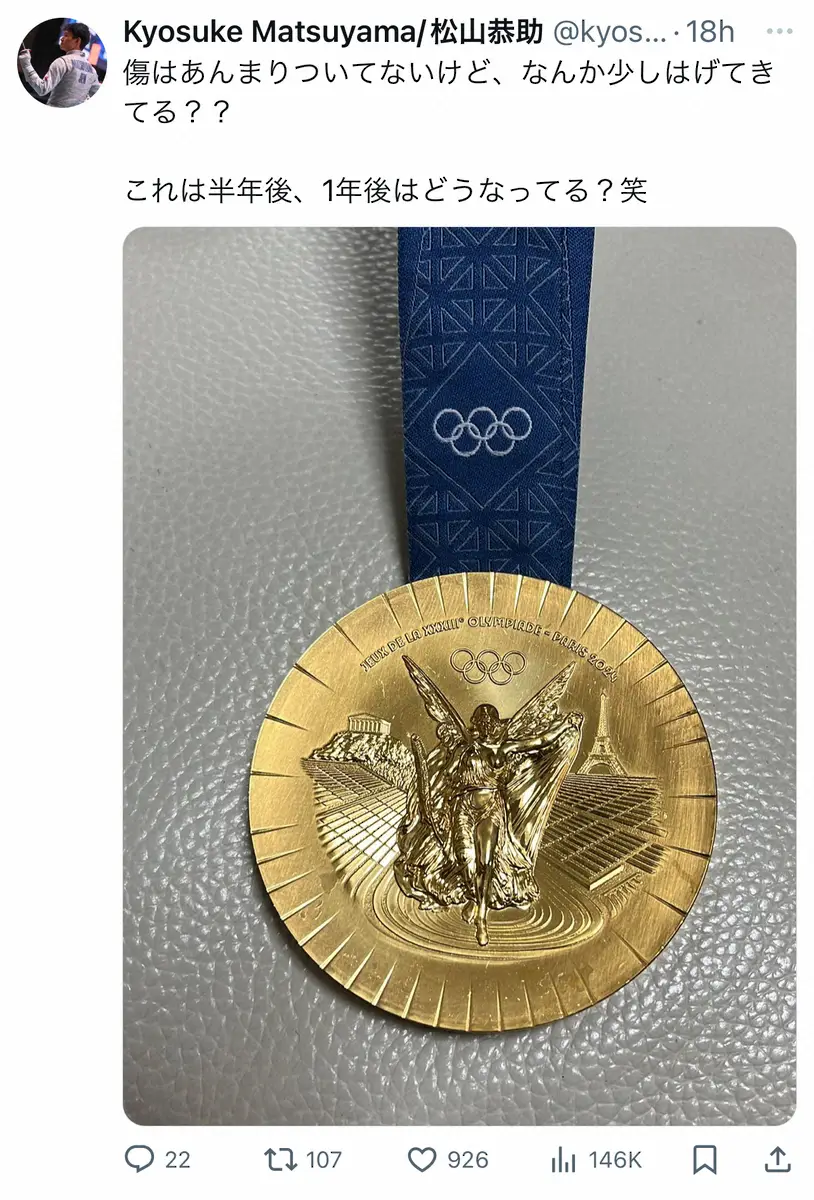 【画像・写真】フェンシング団体金・松山恭助「少しはげてきてる？？」メダル公開　ネット「質も様々」「なんだかなぁ」