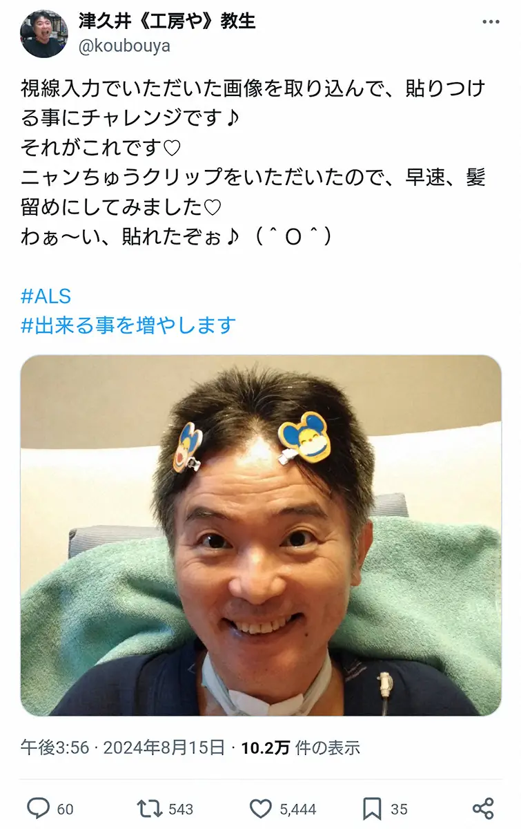 【画像・写真】難病ALS公表の声優・津久井教生「進行のスピード衰えず」　呼吸機能低下で“新たな挑戦”明かす