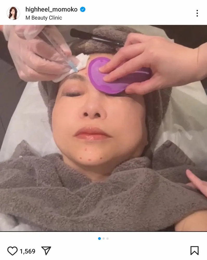 【画像・写真】ハイヒール・モモコ、プチ整形告白「ボトックスを眉間のシワに打ちました」「色々やりたがるのがわかった」