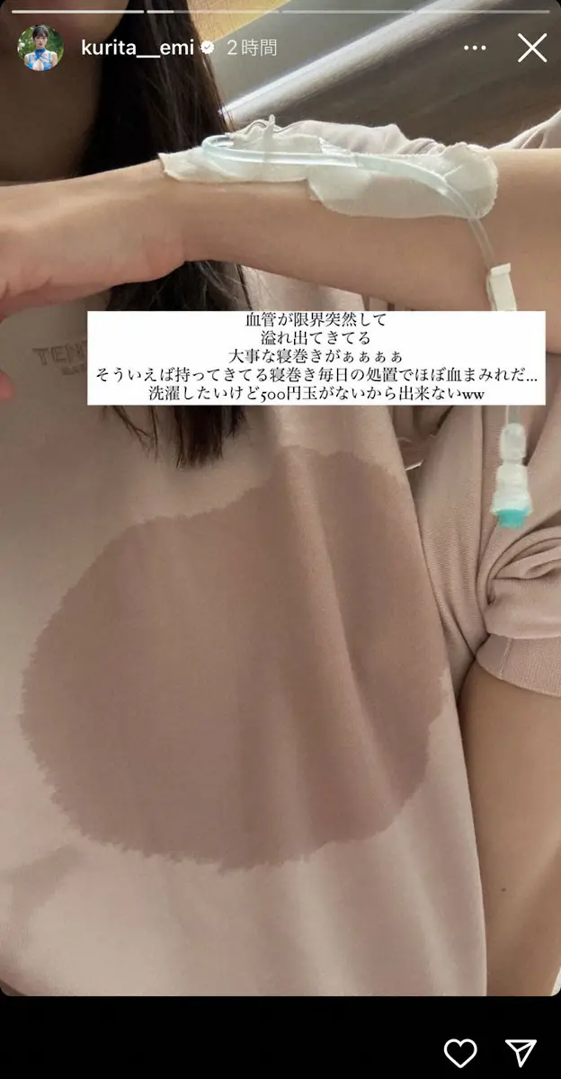 【画像・写真】重度の感染症で入院した美人グラドル「血管が限界突破して…」まさかの“ハプニング”明かす