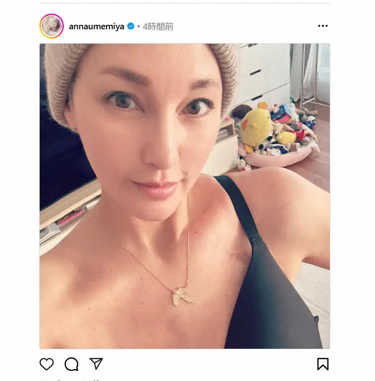 【画像・写真】右胸全摘の梅宮アンナ　術後の悩み告白「着けるブラがない」「傷にあたり、脇にあたり痛くて…」