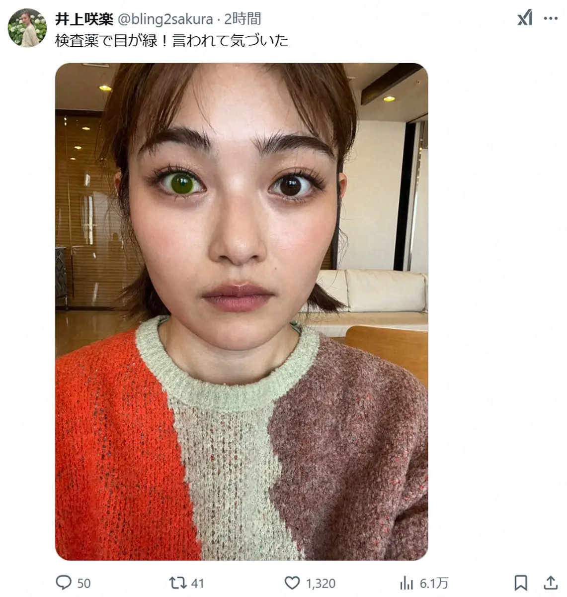 【画像・写真】井上咲楽　衝撃の“オッドアイ”「言われて気づいた」フォロワー驚き「神秘的」「宇宙人感」「カラコン」