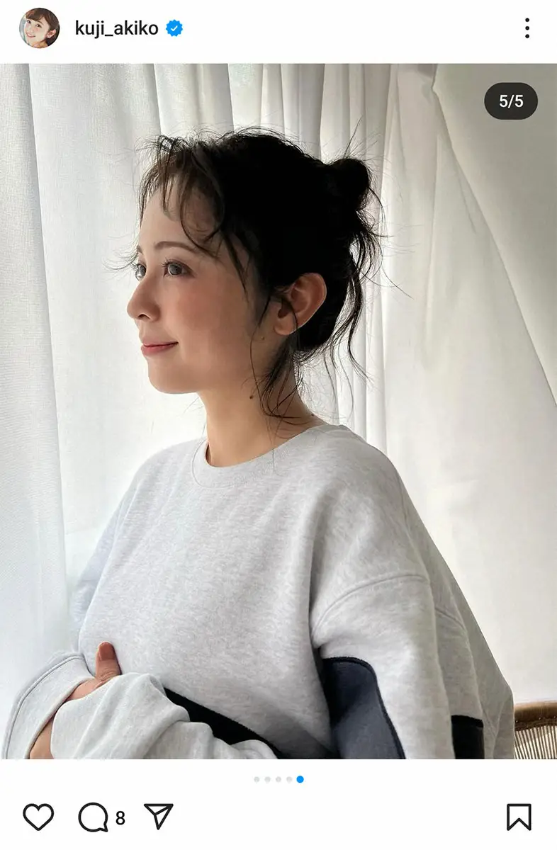 【画像・写真】久慈暁子　普段とは一転…おだんごヘアを披露「小さい頃は髪くるくるでした」に「かわいい」「新鮮」の声