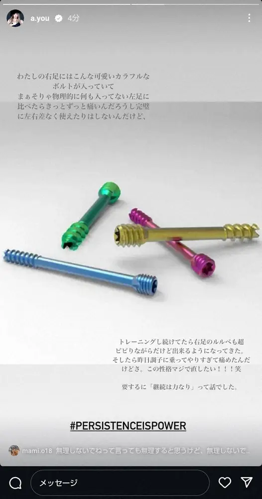 【画像・写真】浜崎あゆみ「きっとずっと痛い」突然の“右足のボルト”告白にファン衝撃「聞いてない」「無理しないで」