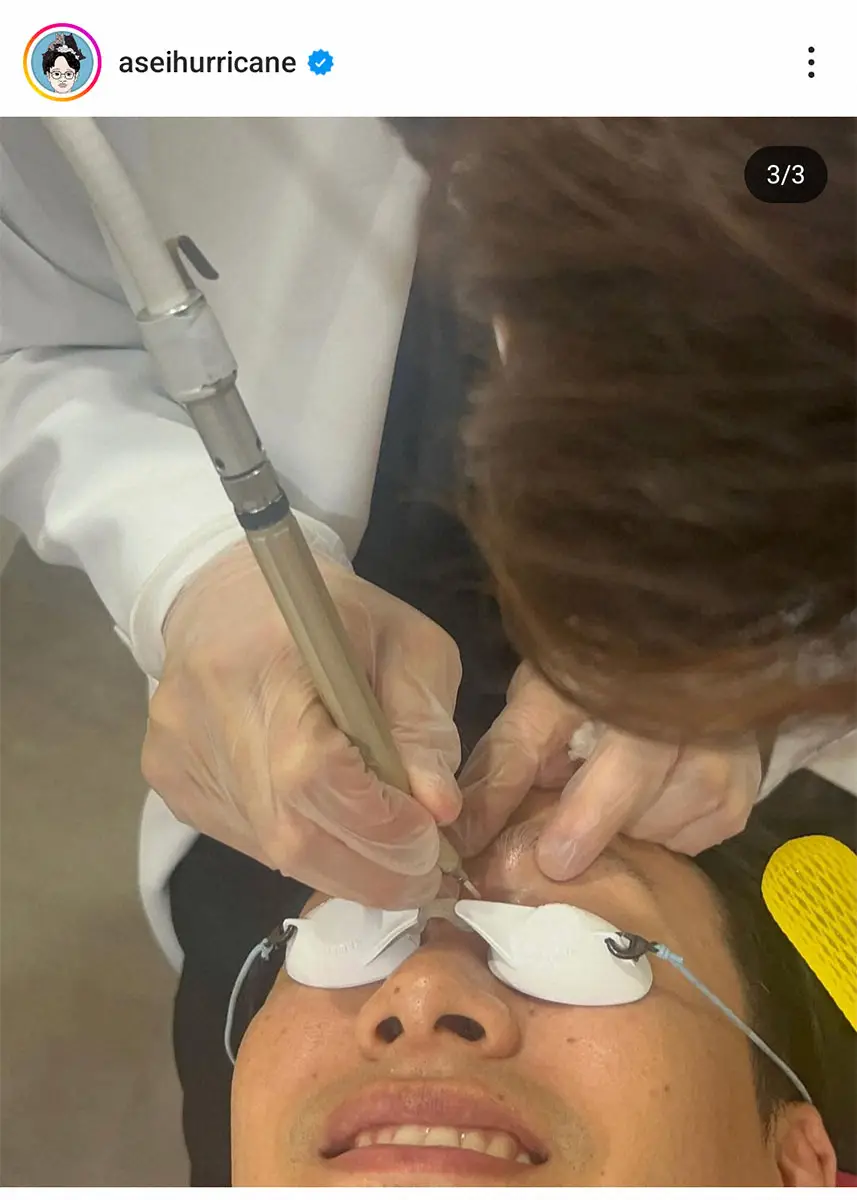 【画像・写真】ミキ亜生　現役医師芸人からイボ取り治療を受けたと明かす「確実に名医でした！」