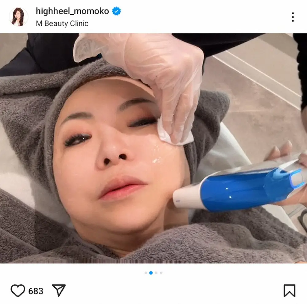 【画像・写真】ハイヒール・モモコ「メンテナンスは大事！」美容施術中の“半目写真”で力説「仕事と思ってます」