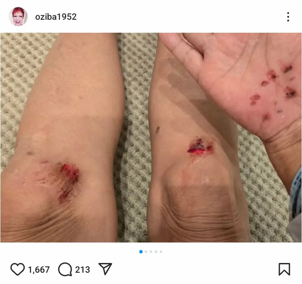 【画像・写真】痛っ！72歳・池畑慎之介　深夜の駐車場で車止めにつまづき転倒「皆様もお気をつけて…」