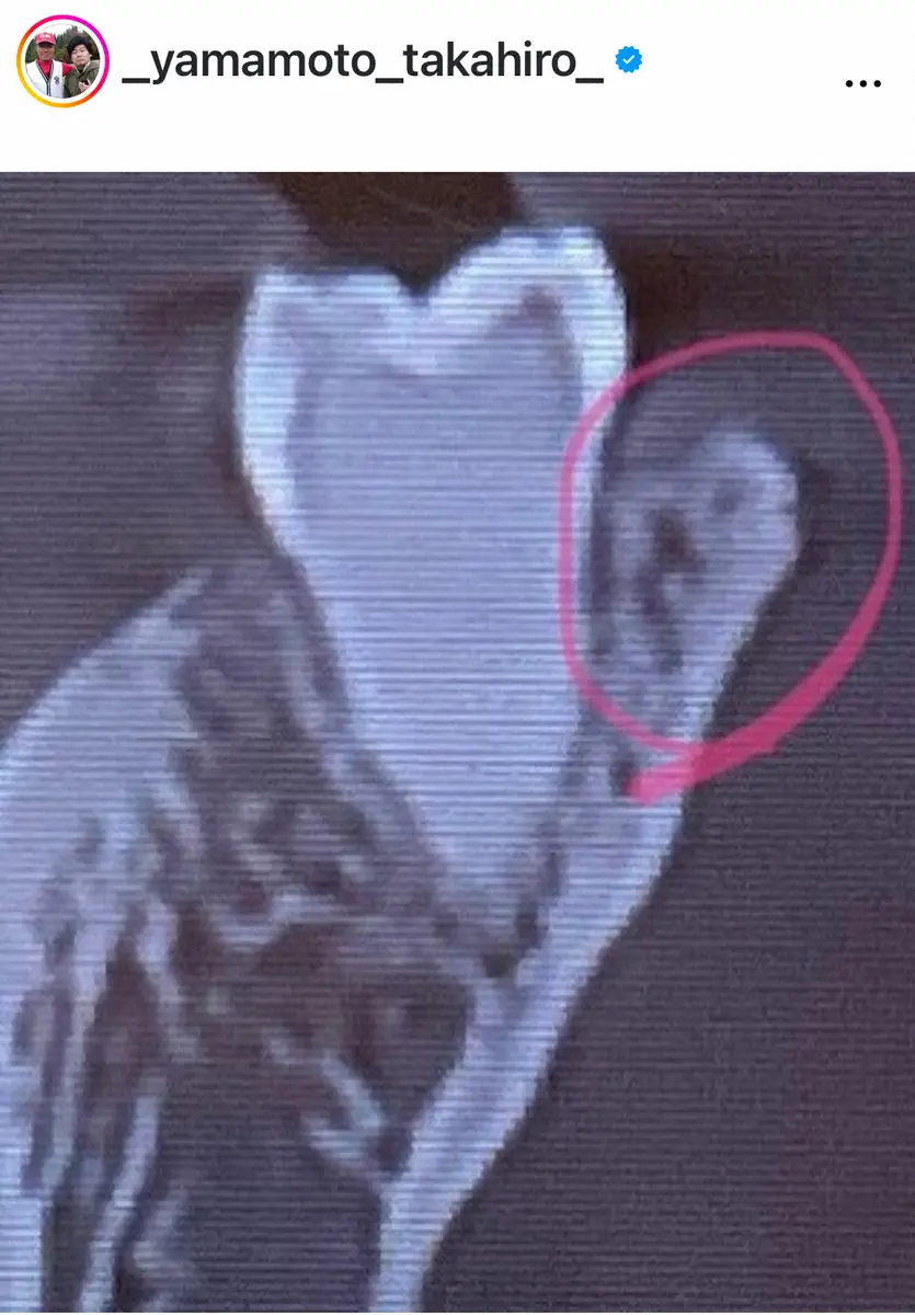 【画像・写真】50歳・人気ものまねタレント「アゴの骨削って3針縫いました」報告に「お大事に」「大丈夫ですか？」の声