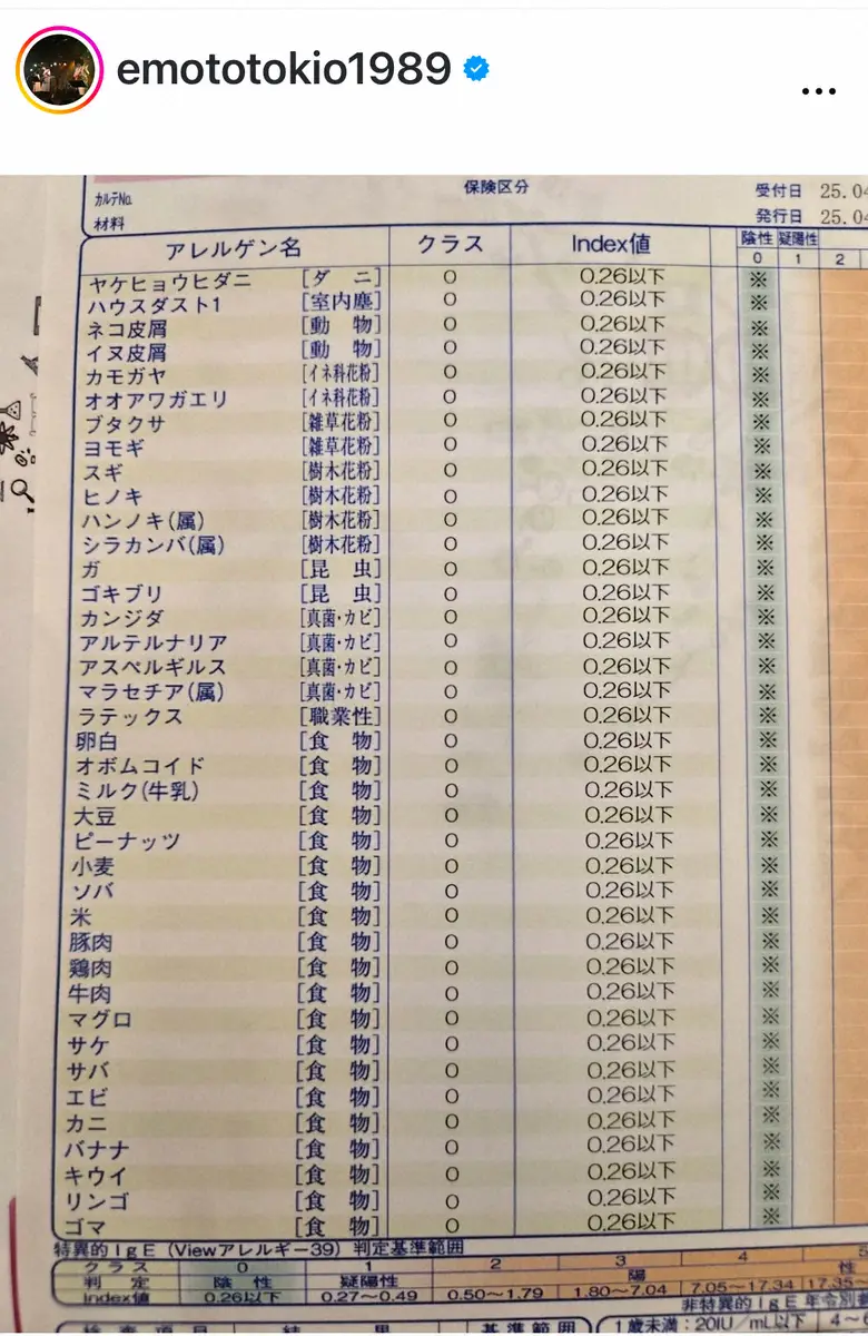 【画像・写真】柄本時生　「『珍しいです』って先生に」衝撃のアレルギー検査公表「なんで君だけ限界突破なん？」
