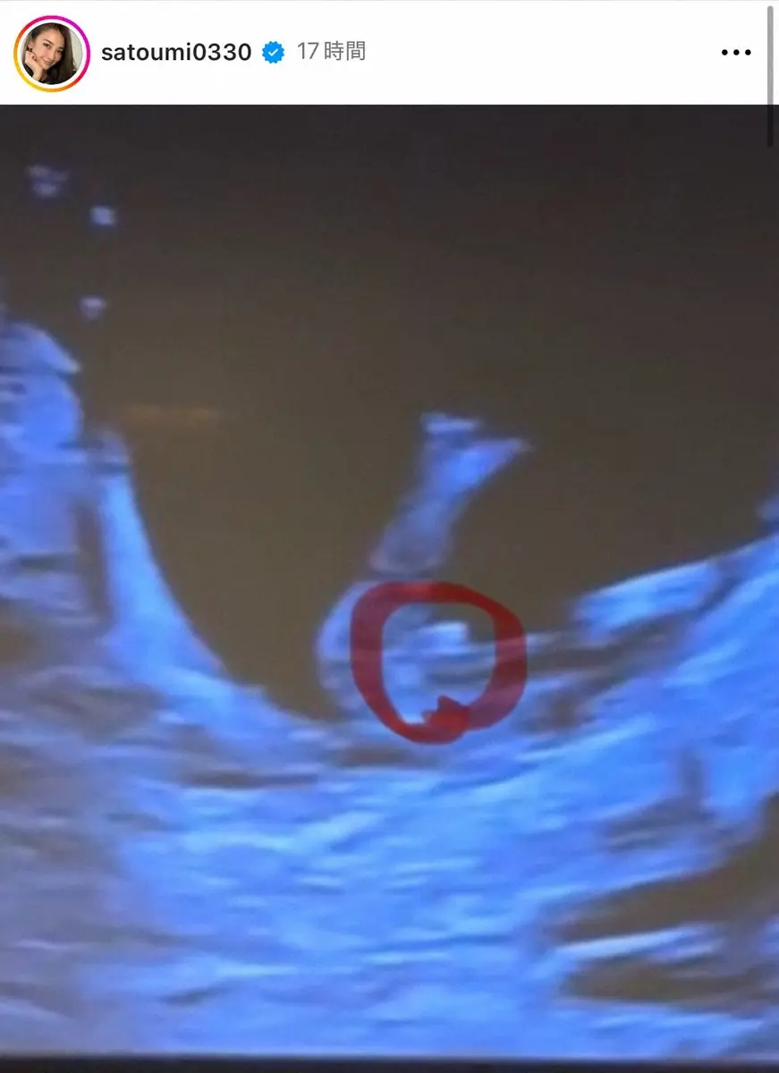 【画像・写真】39歳人気モデル　「順調に39歳で出産」第2子妊娠を発表　エコー写真確認し「こ、これは、、」